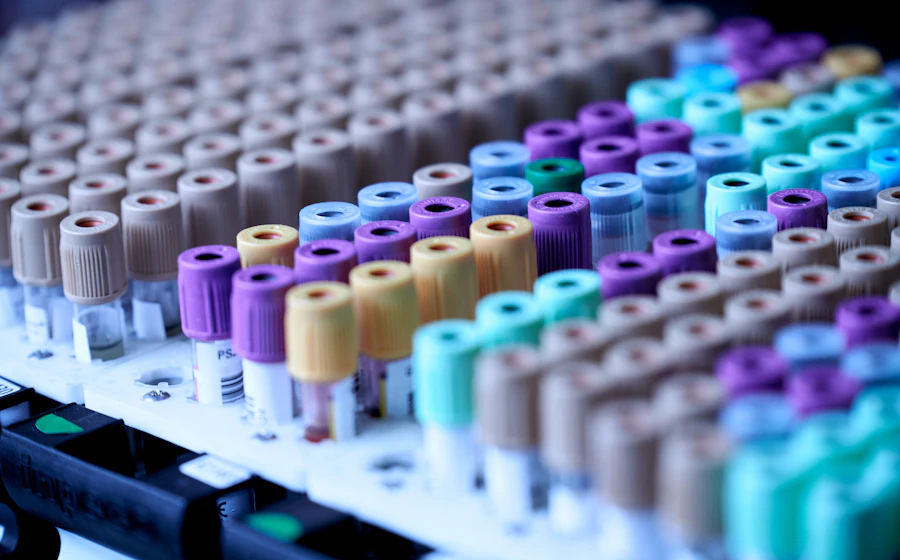 Racks of colour-coded blood sample tubes in a laboratory